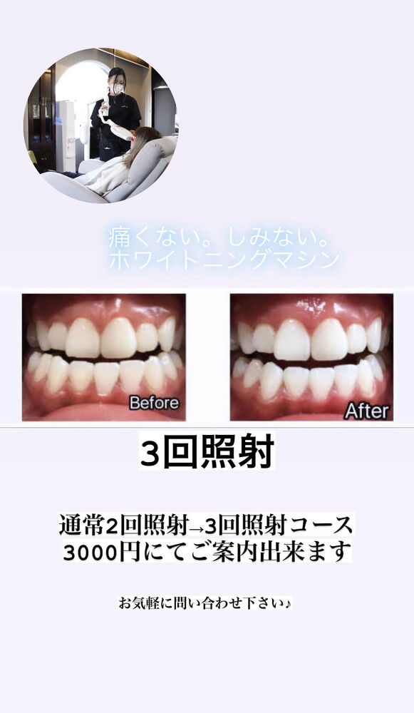 画像1324